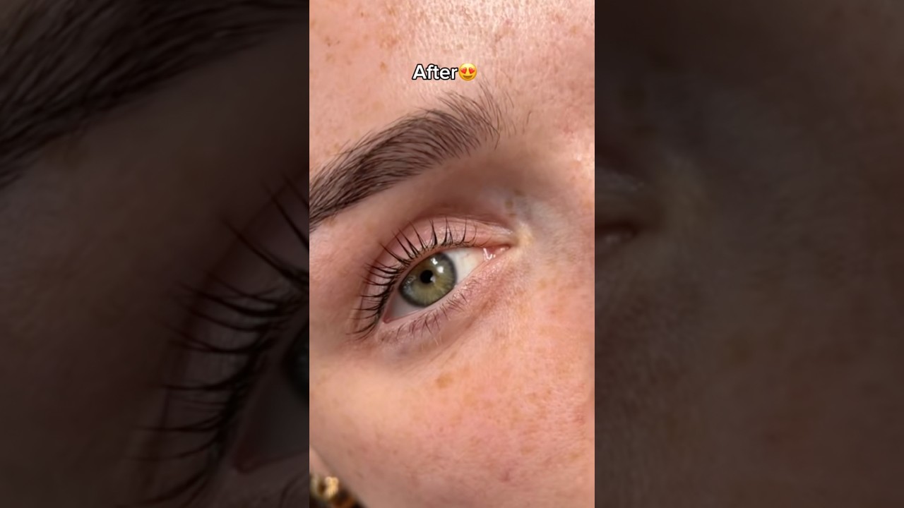 🫶 Results that speak for themselves 