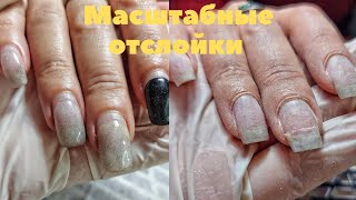 КОГДА ДЕЛАЛИ НОГТИ БЕЗ СВЕТА 😔😜ОТСЛОЙКИ. УКРЕПЛЕНИЕ НОГТЕЙ ГЕЛЕМ. ЛЕГКИЙ ДИЗАЙН НОГТЕЙ