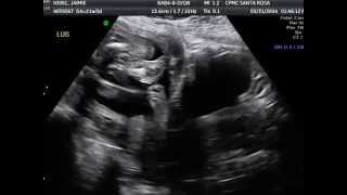 my baby boy!!