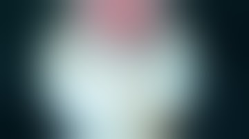 CẮT NỘI SOI PHÌ ĐẠI TUYẾN TIỀN LIỆT. 26/7/2019.TTUT.TS.BS.Duong Van Trung☎0913534343