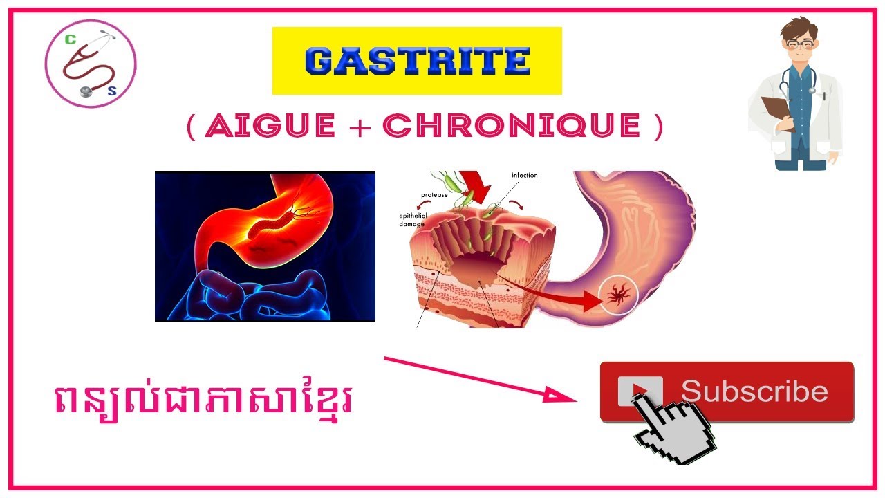 Gastrite Aigue Et Chronique YouTube