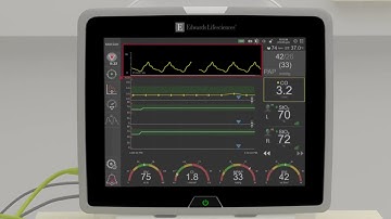 Chapter 2: HemoSphere monitor v.2_2020 - Invasive mode Navigation Bar