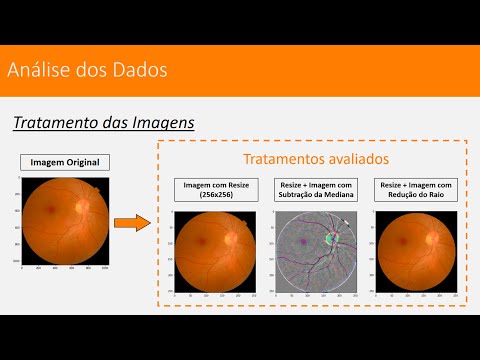 Blindness Detection - Work4Data