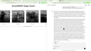 Optimizing BreastMNIST Model: Training, Deployment & Performance Insights