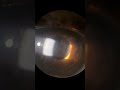 Cells and flare in the anterior chamber#eyes #eyehospital#optometry#viral#eyevision #cataract