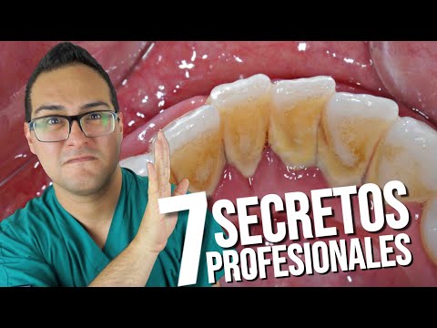 Como QUITAR el Sarro💩 de los Dientes 👅 ANTES DE QUE SALGA ¡LOS 7 SECRETOS PROFESIONALES!🤓