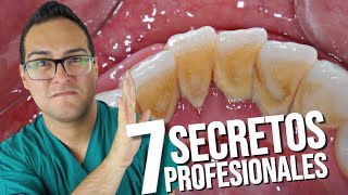 Como QUITAR el Sarro💩 de los Dientes 👅 ANTES DE QUE SALGA ¡LOS 7 SECRETOS PROFESIONALES!🤓