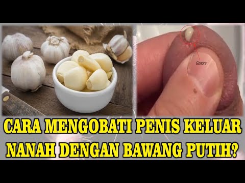 cara-mengobati-penis-keluar-nanah-dengan-bawang-putih-^^