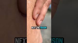 The Science Of A Jellyfish Sting