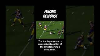 Fencing Response Example Courtesy of American Football