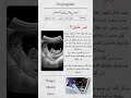 احلى خبر بشرت فيه جريدة نقالين العلوم اكسبلور جريدة بشارة حمل