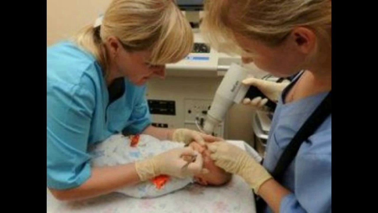 ретинопатия недоношенных лазерокоагуляция Retinopathy of prematurity ...