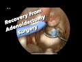 Post Op Adenoidectomy:  how much pain, what not to eat, what activities to avoid, when is post op