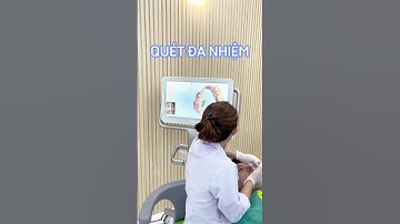 MÁY SCAN ITERO - BIẾT TRƯỚC KẾT QUẢ NIỀNG RĂNG CHỈ TRONG "TÍC TẮC"