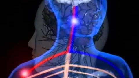 B1.12 Sensitivity CNS & Neurones