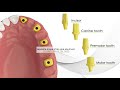 BioLine abutments demonstration video. 3D medical theme video