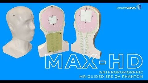 MR-Guided SRS QA Phantom: MAX-HD