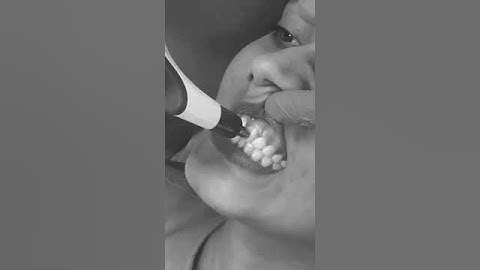 Digital Shade guide for 100% shade matching