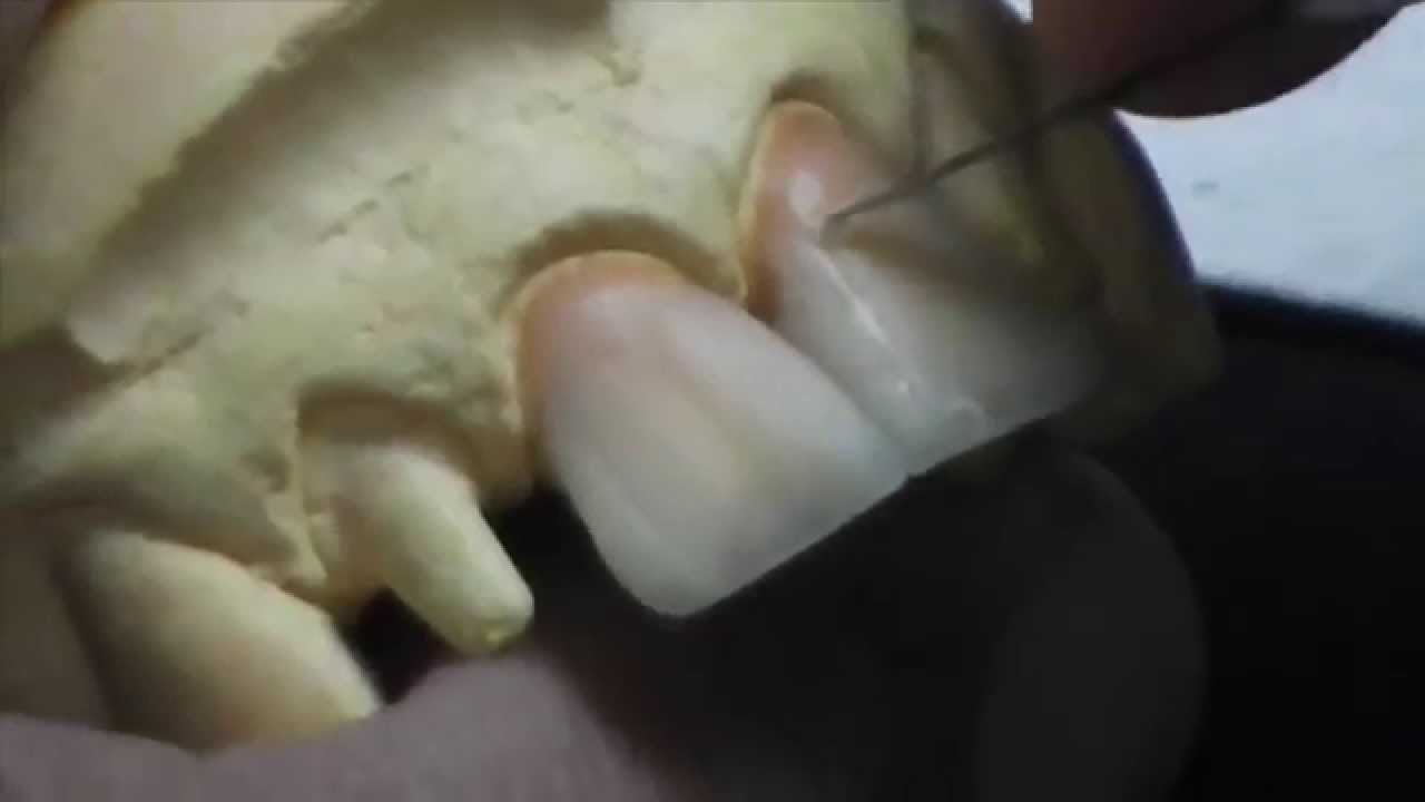 Curso Técnica Dental - 