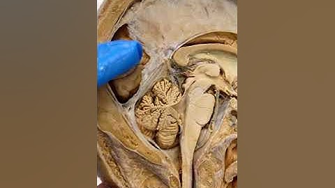 This Is What Connects Both Sides of Your Brain | The Corpus Callosum