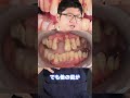 この患者さんどう治す?#shorts