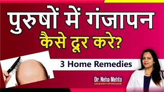 3 Natural ways to Stop Hair Loss in males in (Hindi & Urdu)  || Dr. Neha Mehta