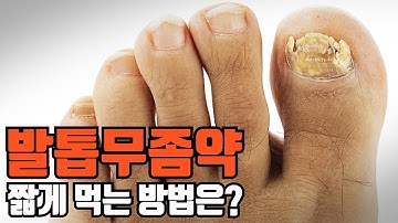 발톱무좀약, 단기간만 먹는 방법은 없을까? / #발톱무좀 / #발톱무좀약 / #발톱무좀약복용법