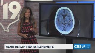 Study finds link between minor heart problems and brain tissue damage tied to Alzheimer's