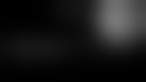 Rendezvous Biliary Recanalization of Complete Biliary Obstruction With Direct Peroral and... Video 3