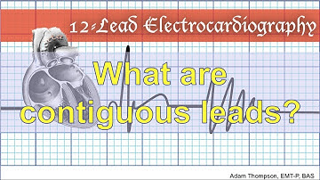What are contiguous leads?
