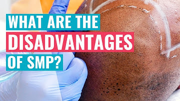 What Are The Disadvantages of Scalp Micropigmentation? An SMP Practitioner Explains