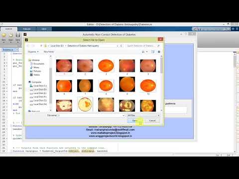 Matlab Code On Diabetic Retinopathy Classification Using Image Processing | With Source Code