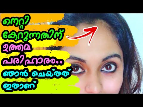 💯നെറ്റിയിൽ പുതിയ മുടി വരും ഇത് ഉപയോഗിച്ചാൽ | Home remedy for forehead hair  growth in malayalam - YouTube