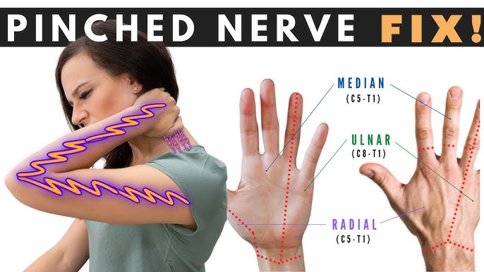 INSTANT RELIEF - How to Treat A Pinched Neck Nerve - Physical Therapy  Exercises 