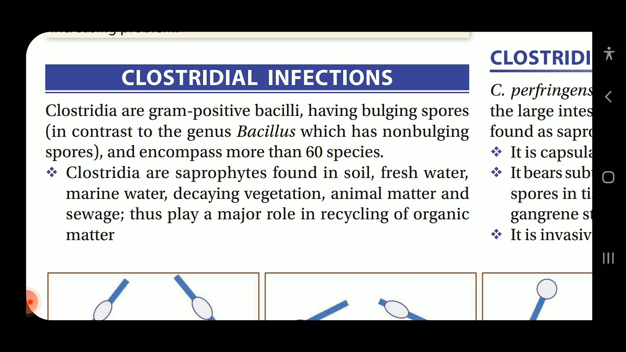 Apurba S Sastry Microbiology Gas gangrene and non sporing microbe infections
