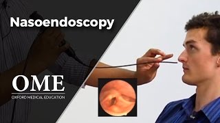 Nasoendoscopy (Nose Examination) - ENT by Oxford Medical Education 625,329 views 12 years ago 2 minutes, 58 seconds