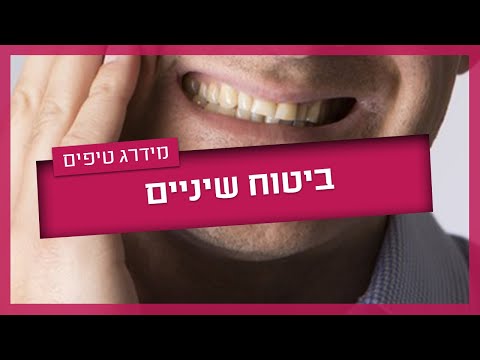 ביטוח שיניים פרטי - כל מה שחשוב לדעת