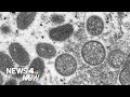 Monkeypox Outbreak Hits Westchester as Suspected NYC Case Count Rises | News 4 Now