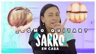 Cómo quitar el Sarro de los Dientes | Causas y soluciones del Sarro Dental