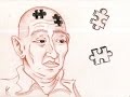 ¿Cuáles son las 7 fases de la enfermedad de Alzheimer?