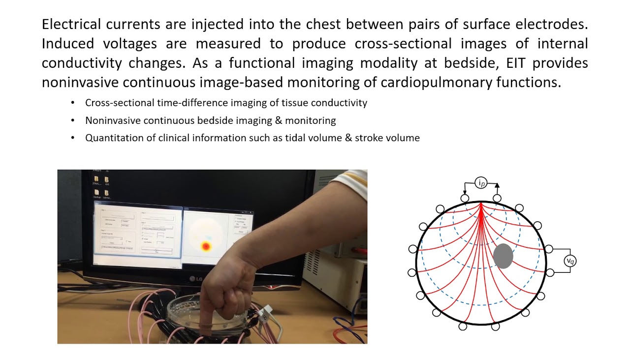 thesis on electrical impedance tomography