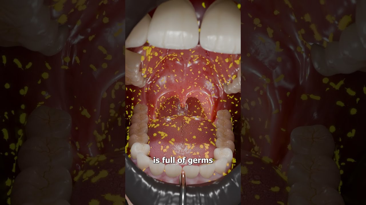 Why You Shouldn T Pierce Your Uvula 
