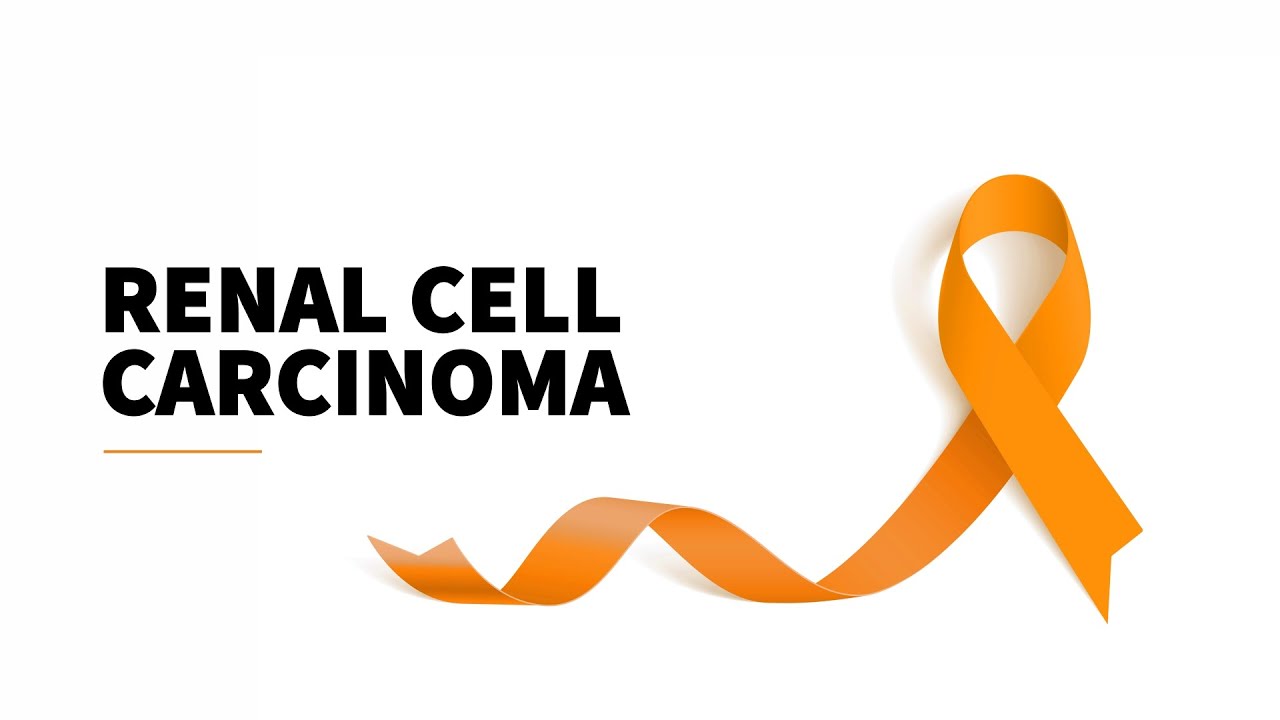 Photo inspiration: Picture Idea: The Genetics Of Renal Cell Carcinoma