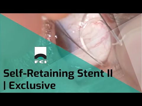 Vignette Self-Retaining Stent II | Features & Procedure