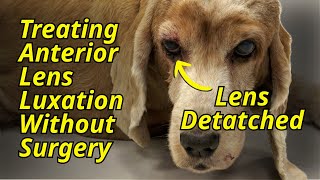 Treating anterior lens luxation without surgery | The Eye vet- Episode 65