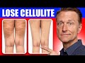 A BETTER Way to Lose Flabby Cellulite on Your Hips, Thighs and Buttocks - Dr. Berg