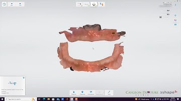 Digital Scans with Preliminary Bite Registration