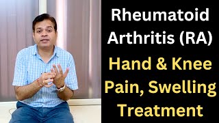Rheumatoid Arthritis, Symptoms of Rheumatoid Arthritis, Pain in Hands and Knee, Rheumatoid Arthritis