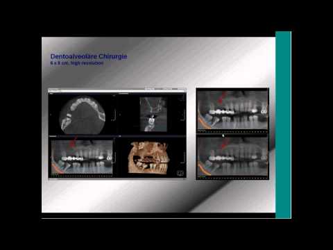Video: Computergestütztes Bildgebungs- Und Hämodynamik-Framework Zur Funktionsanalyse Und Bewertung Kardiovaskulärer Strukturen