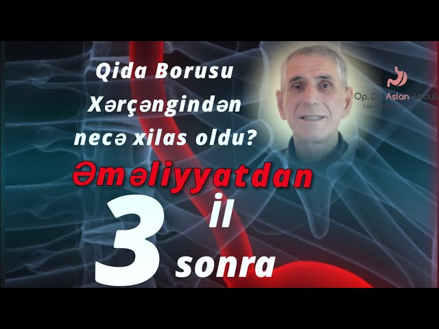 Qida borusu xərçəngi, qapalı əməliyyatdan 3 il sonra